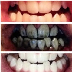 Activated Charcoal Teeth Whitening Powder